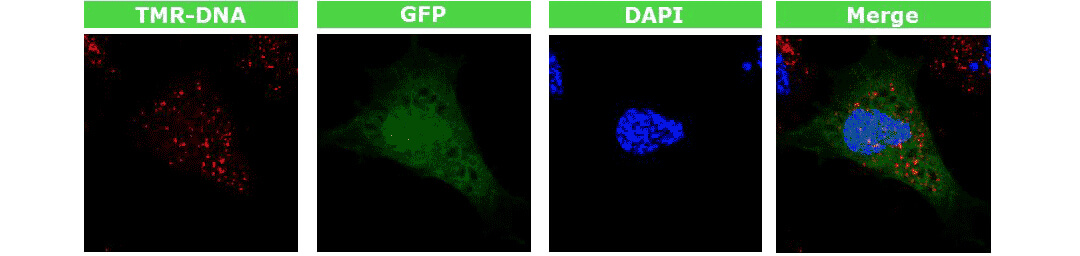 4D-nucleofector核轉儀轉染GFP質粒快速表達